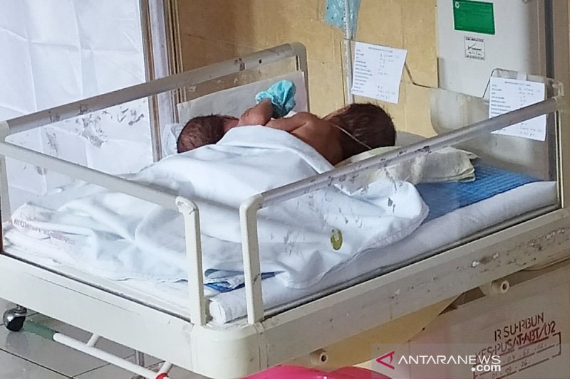 Bayi Kembar