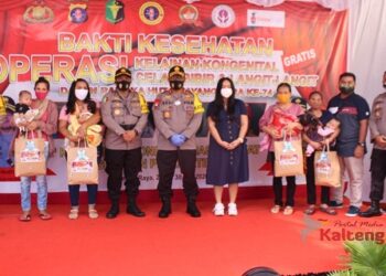 Polda Kalteng Gelar Bakti Kesehatan, Operasi Bibir Sumbing Gratis