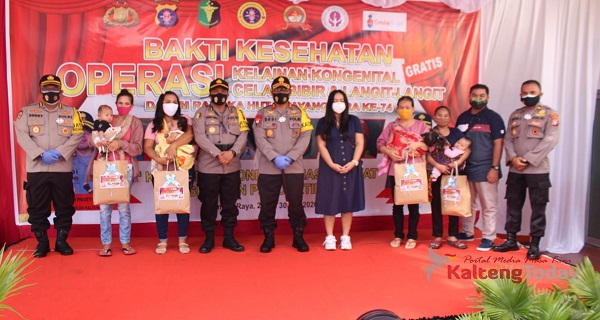 Polda Kalteng Gelar Bakti Kesehatan, Operasi Bibir Sumbing Gratis