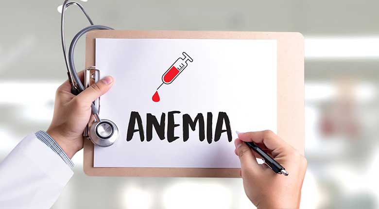 anemia penyebab rambut rontok