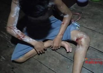 Asik Cari Kerang Disungai, Jakal Malah Diserang Buaya Ganas