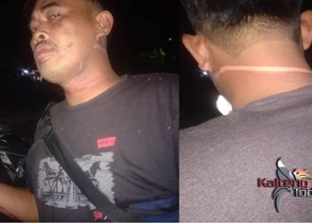 Berkendara Motor Malam Hari, Pria ini Terpental 8 Meter Akibat Terlilit Kabel Membentang di Jalan Raya
