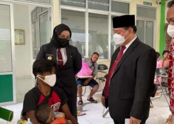 RSUD dr Murjani Sampit Gelar Operasi Bibir Sumbing
