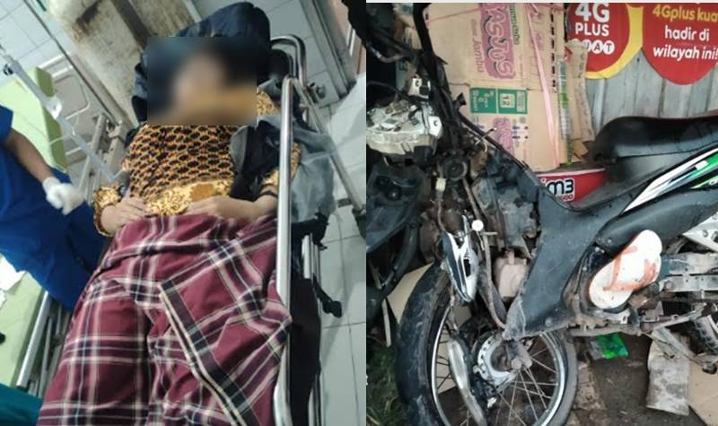 Masuk Jalur Berlawanan, Pengendara Sepeda Motor Seruduk Mobil Hingga Patah Tulang