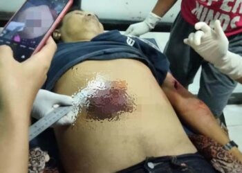 Astaga! Ditusuk OTK, Jagau Tewas dengan Usus Terburai