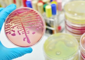 2 Pekan Pemeriksaan, BBPOM Temukan Temukan Bakteri E. Coli pada Kasus Kue Ipau